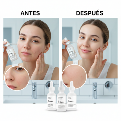 THE ORDINARY - Pack Completo Anti Acné